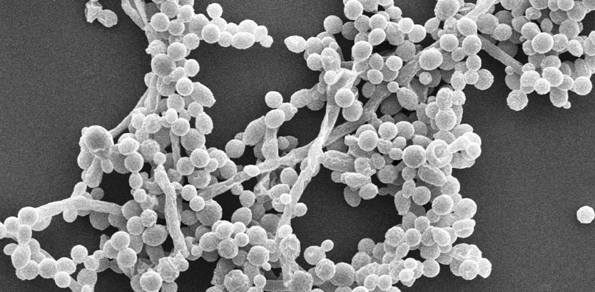 An image of the yeast Spathaspora passalidarum taken by electron microscopy. Credit: Dana Wohlbach and Thomas Kuster.
