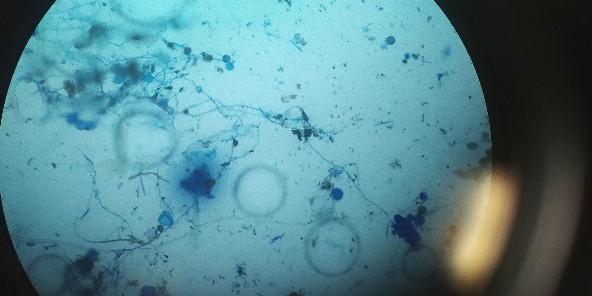 microscopic view of fungi