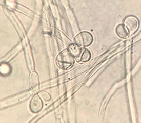 Ambrosia monospora