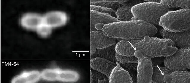 Black and white images of bacteria with an altered protein called DalA show cells dividing (left) and with deformations (right).