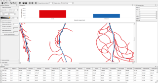 A screenshot of the RhizoVision Explorer interface