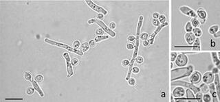 Microscope images of Saccharomycopsis praedatoria strain UFMG-CM-Y6632