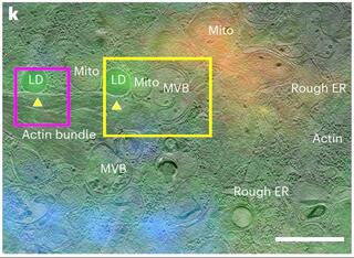 Superimposition of the iFLM image and the reconstructed 3 × 3 cryo-ET montage.