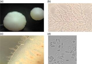 Taxogenomic analysis of a novel yeast species isolated from soil, Pichia galeolata sp. nov.