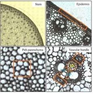 Stem cell type locations in LCM.