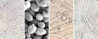 A collage of four budding yeast species as seen by scanning electron microscopy