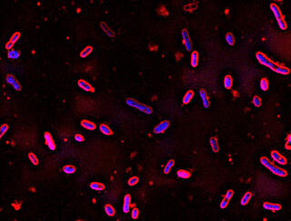 Microscopy image of glowing bacteria