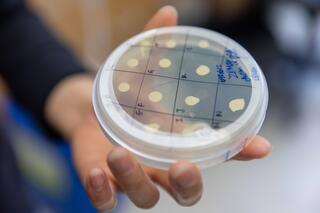 A petri dish with multiple yellow spots
