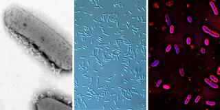 Three side-by-side microscopy images of the alphaproteobacteria Rhodobacter sphaeroides, Zymomonas mobilis, and Novosphingobium aromaticivorans