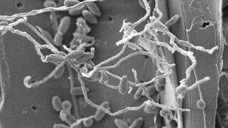 An electron micrograph of the fungus Parascedosporium putredinis NO1