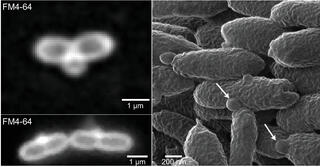 Black and white images of bacteria with an altered protein called DalA show cells dividing (left) and with deformations (right).