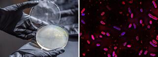 Gloved hands holding a petri dish (left) and iridescent bacteria as seen through a microscope.