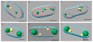Cells are depicted in six panels with cell components tinted for clarity: cell walls are cyan and magenta. PHB granules are green and PP granules yellow. The top row of untreated cells have multiple small PHB and PP granules while the bottom row of treated cells have only one or two much larger granules arranged at the extremeties of the cell.