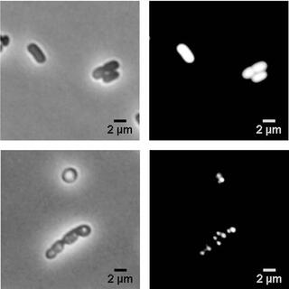 The images on the left show bright-field micrographs, while the images on the right display fluorescence micrographs of the same cell samples. Cells in the top frames appear elongated; those in the bottom frames appear more circular.